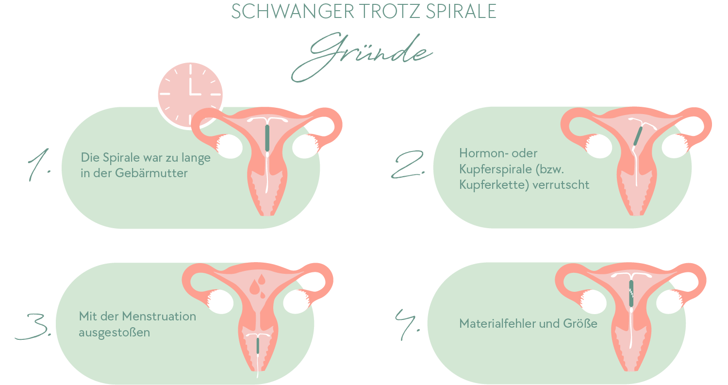 Schwanger trotz Spirale (neu)