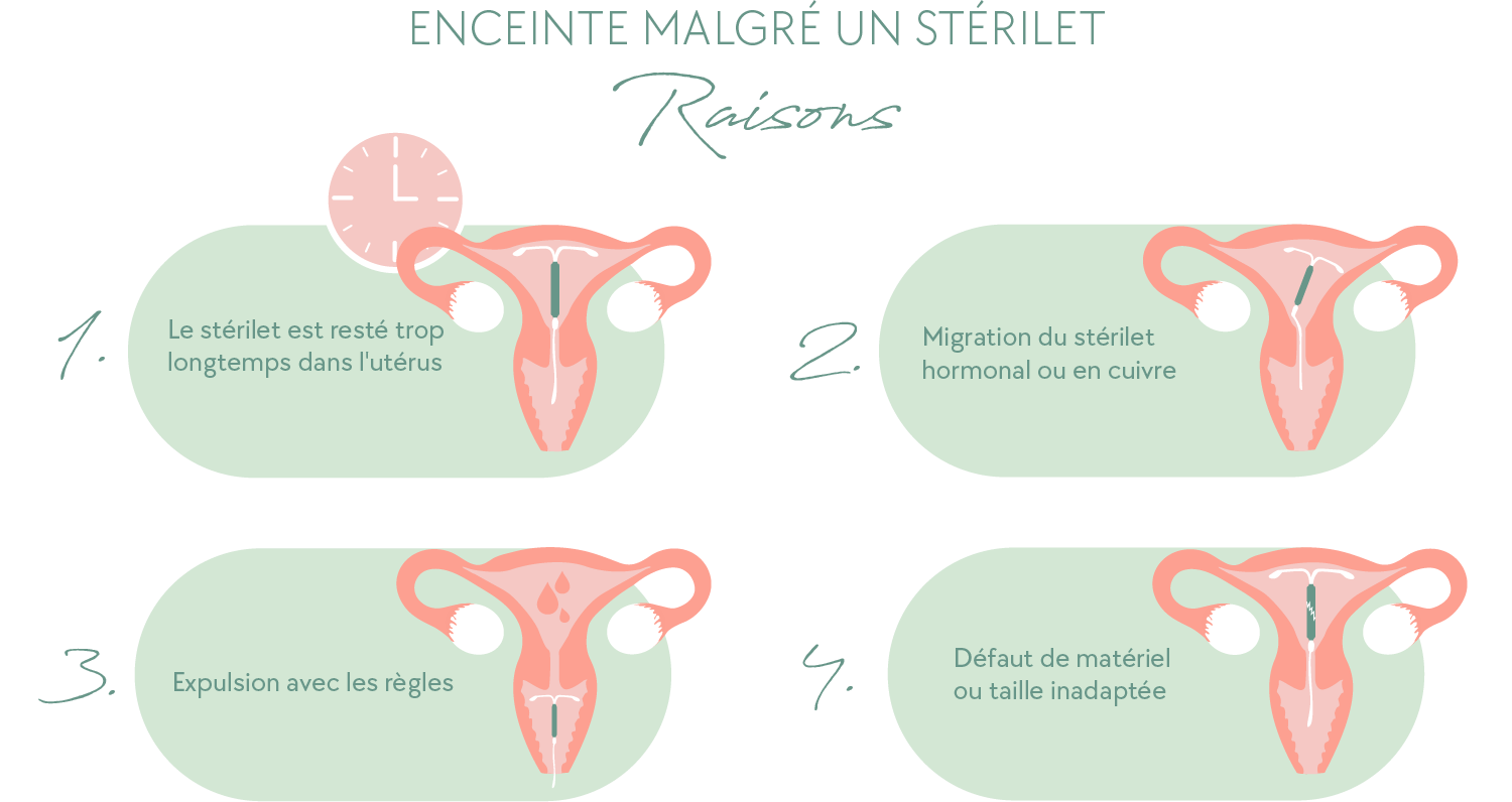 Enceinte malgré un stérilet raisons (desktop)